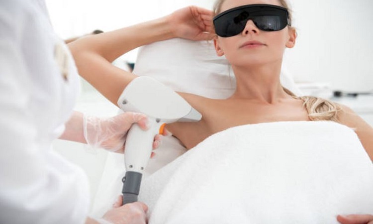 Laser-hair-removal-Naperville